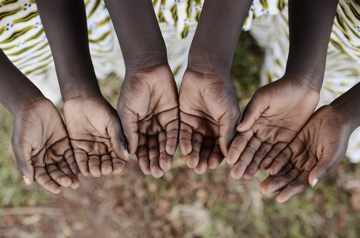 Die Unter- und Mangelernährung in Namibia nimmt zu; © borgogniels/iStock